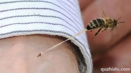 身体的哪个部位被蜜蜂蛰最疼？