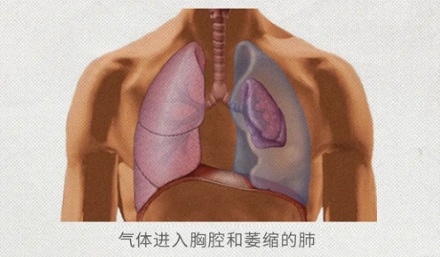 为什么被刀捅后无法发出「啊啊」的声音？