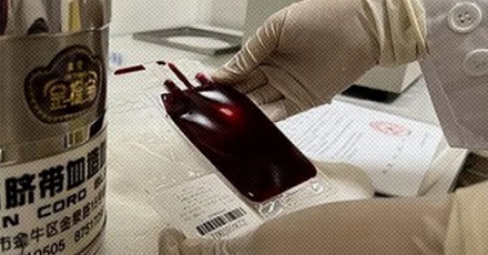 为什么脐带血可以治疗白血病？