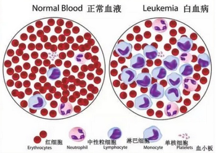 为什么脐带血可以治疗白血病？