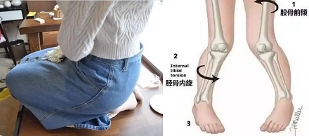 为什么日本女性走内八字的那么多?
