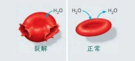 用注射器往一个人臀部注射一管目来水,这个人会怎么样?