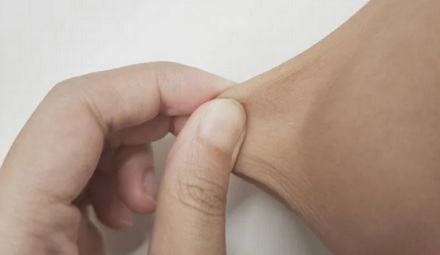 胳膊肘的皮为什么是「死皮」，怎么掐都不疼？