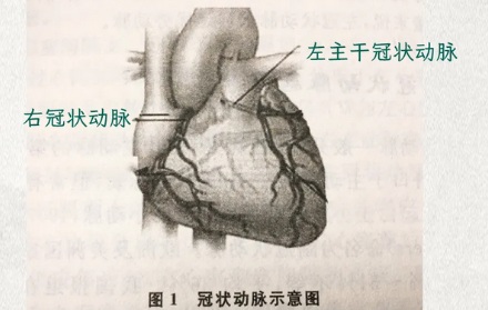 明明是做心脏支架手术，为什么却要在手腕上开一刀？