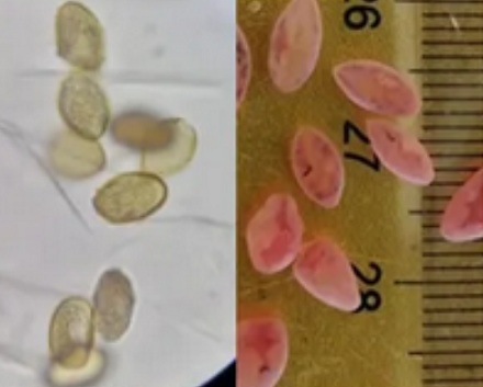 为啥梭子蟹鳃里密密麻麻的「寄生虫」，根本不用怕？