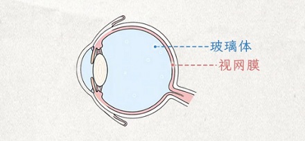 为什么跳水运动员的视力都不太好？