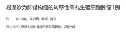 为啥有的肿瘤里面会长牙齿头发，甚至骨头？