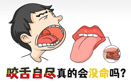 咬舌自尽真的能死吗，是失血死的还是疼死的？