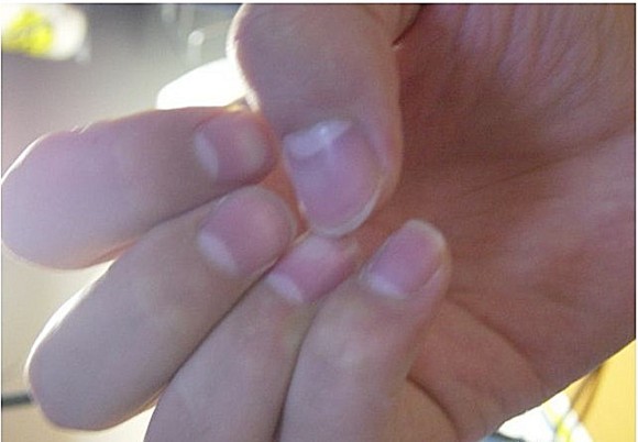 手指甲根部的白色部分叫做半月痕