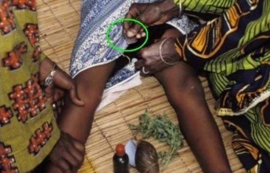 非洲有让女性接受割礼的习俗